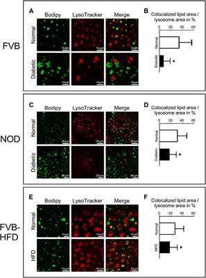 Aberrant lipid accumulation in the mouse visceral yolk sac resulting from maternal diabetes and obesity